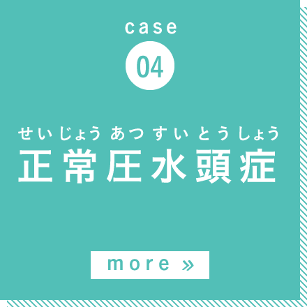 case04 正常圧水頭症 more