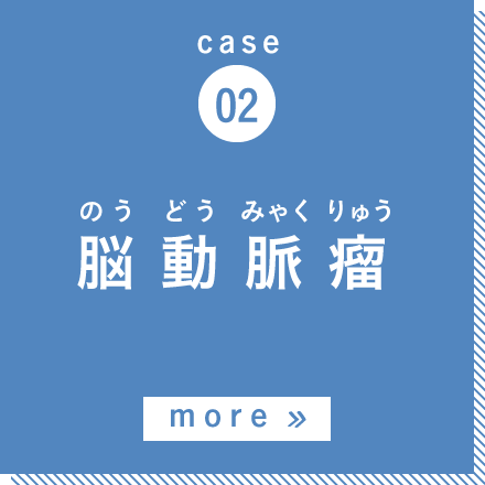 case02 脳動脈瘤 more