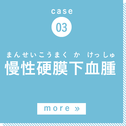 case03 慢性硬膜下血腫 more