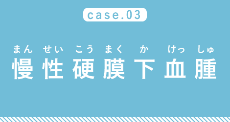 case03 慢性硬膜下血腫