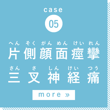 case05 片側顔面痙攣・三叉神経痛 more