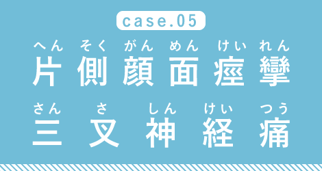 case05 片側顔面痙攣・三叉神経痛