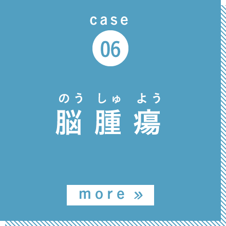 case06 脳腫瘍 more