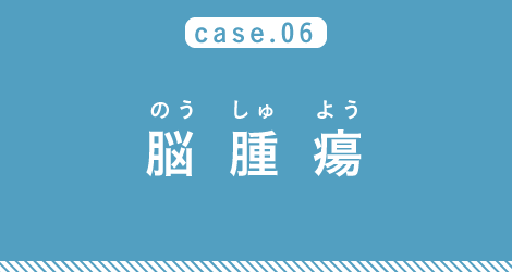 case06 脳腫瘍